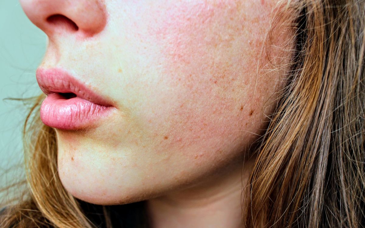 Tipos de piel: fotografía editorial de close view of facial skin texture